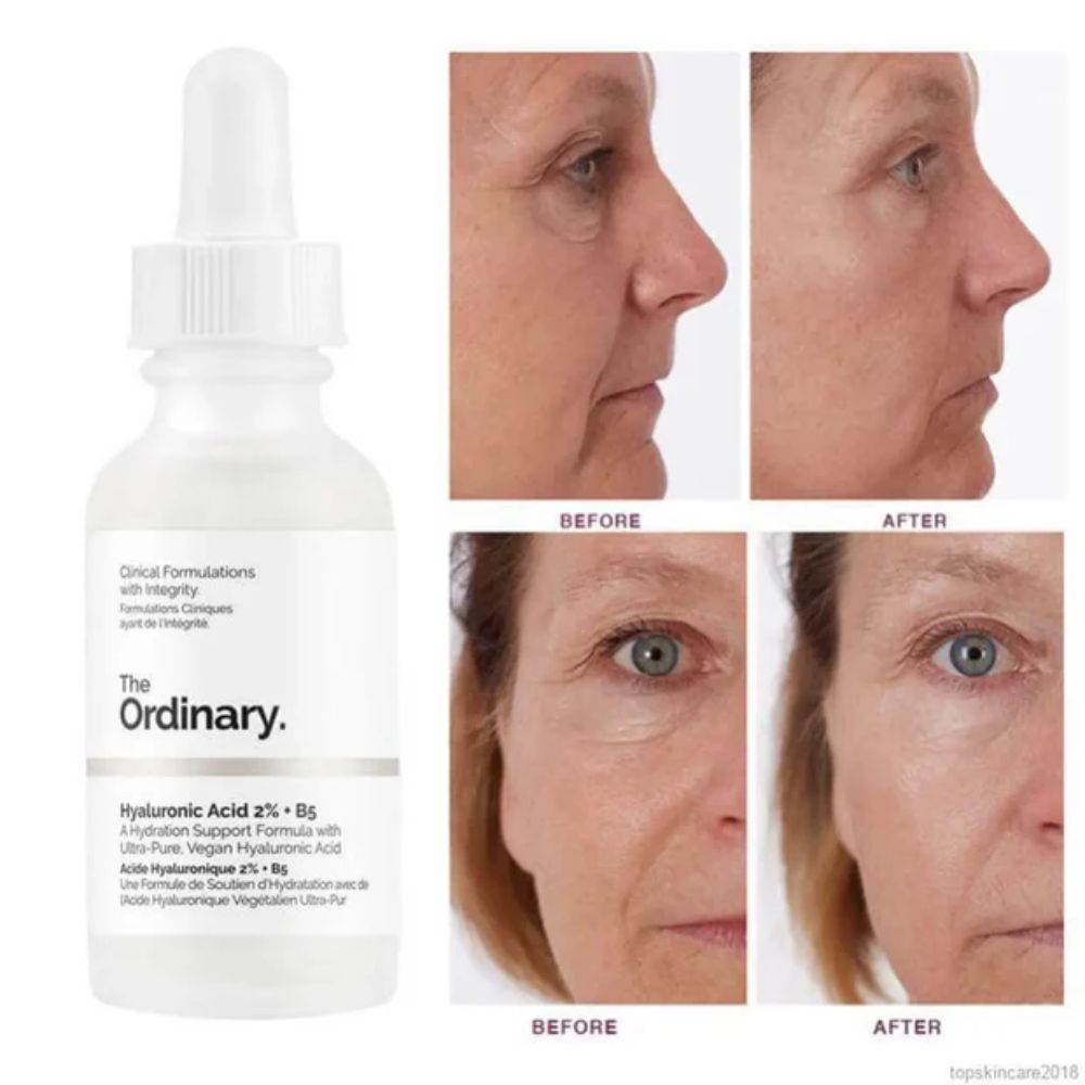 The Ordinary | Hyaluronic Acid 2% + B5